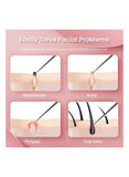 We Happy Protective Tweezers for Unwanted Hair and Blackhead Removal